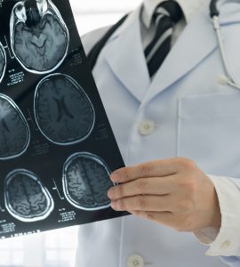 doktor drzi snimak glave